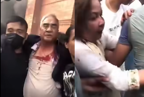 प्रदर्शनकारीको कुटपिटबाट देउवा रगतपच्छे, आरजू पनि घाइते