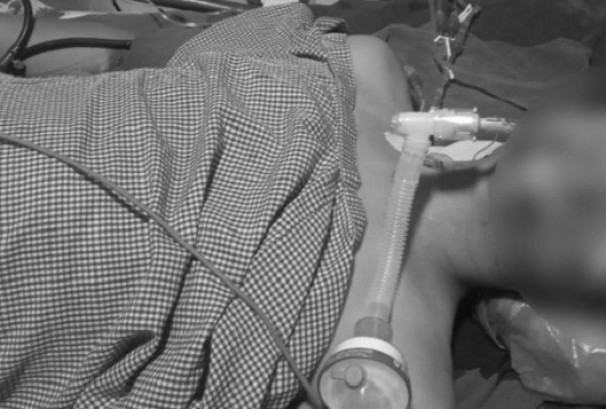 कालिमाटीमा गोली लागेका सुवेदीको निधन