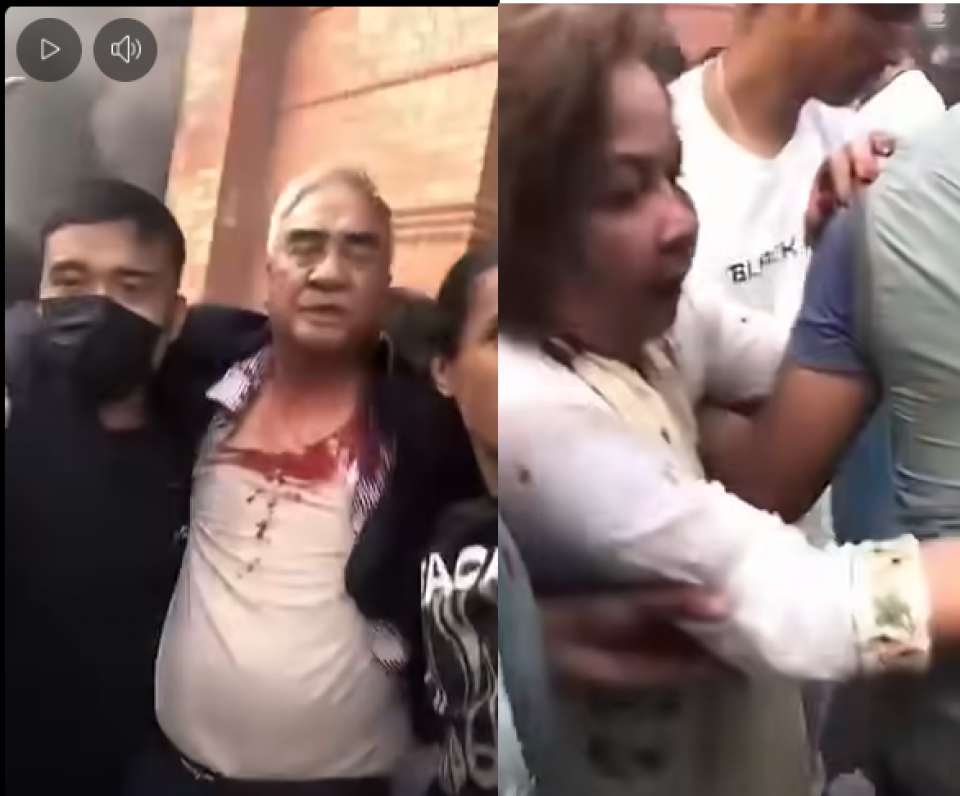 प्रदर्शनकारीको कुटपिटबाट देउवा रगतपच्छे, आरजू पनि घाइते